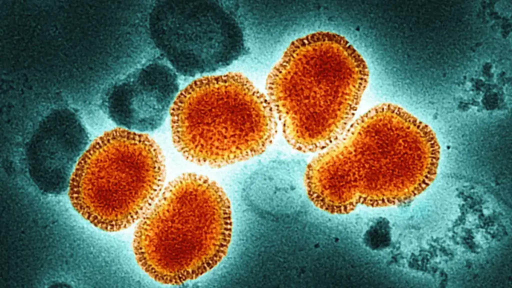 Flu has peaked in Canada but cases remain high, PHAC says Flu has peaked in Canada but cases remain high, PHAC says